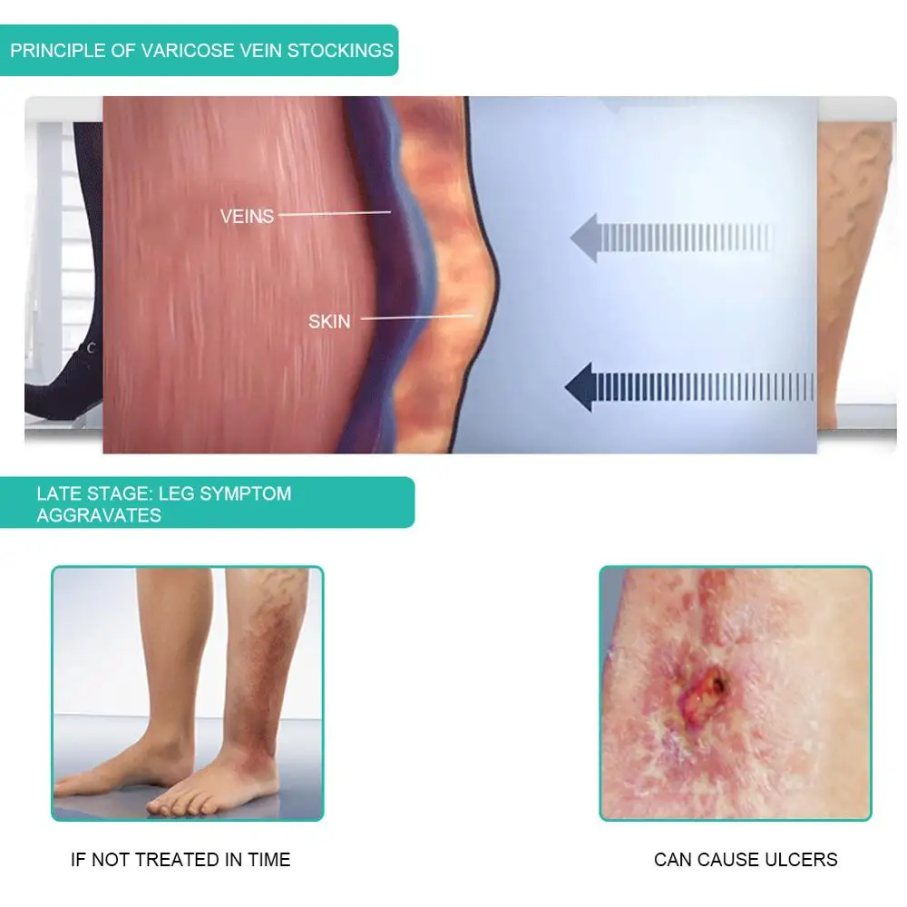 1 زوج جورب ضاغط طبي الجوارب 30 - مراجعة Compression Sock Medical وسعره